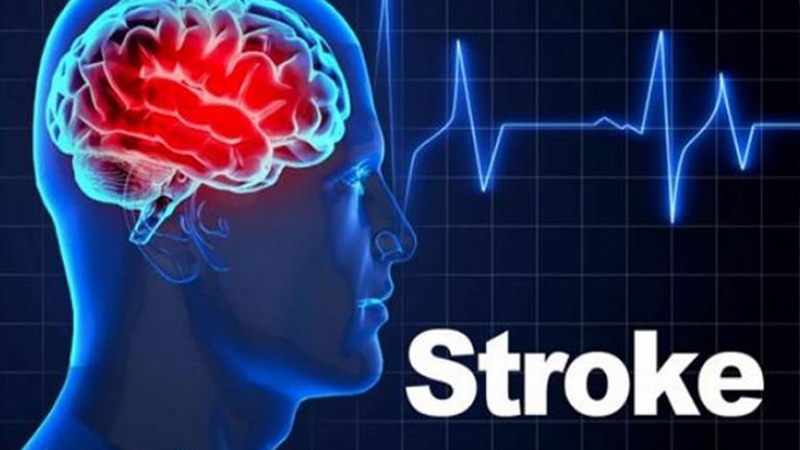 PAFI Ratahan – Penyakit Stroke, Kenali Gejala dan Faktor Risikonya